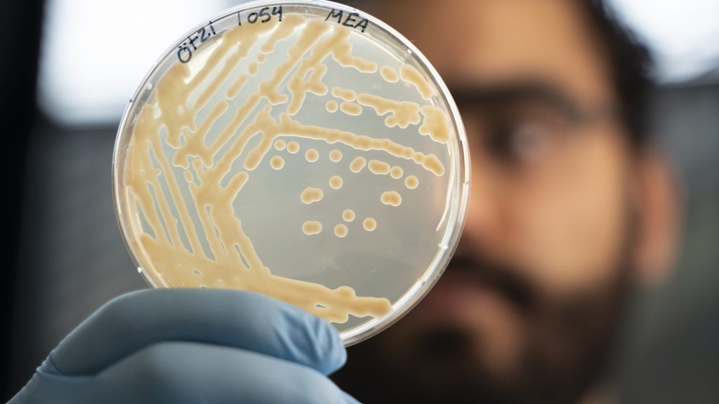 Ötzi Buz Adamda Donmuş Antik Mikroplar Hâlâ Büyümeye devam ediyor.